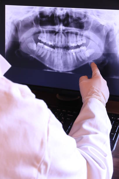 Best Emergency Dental Care for Sports Injuries in Demopolis, AL